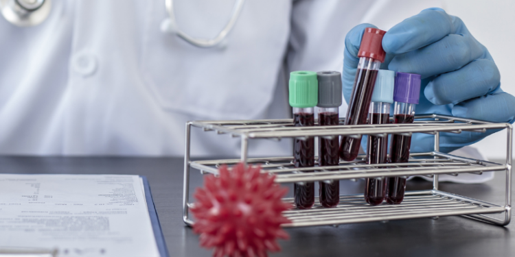 Marburg Virus Outbreak in Rwanda Claims 11 Lives – What You Need to Know